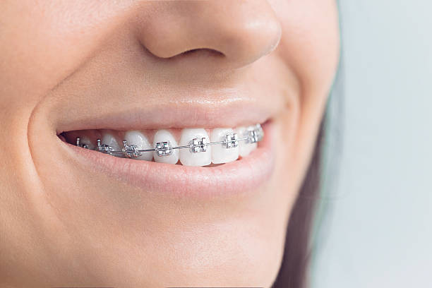 Why Choose Us for Your Dental Needs in Richwood, OH